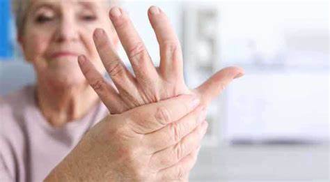 علاج التهاب مفصل اليد