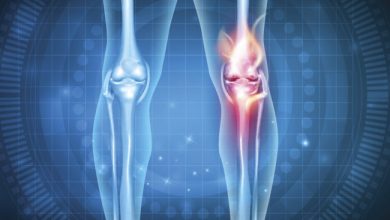 علاج طقطقة الركبة مع ألم