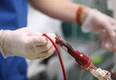 موانع نقل الدم
