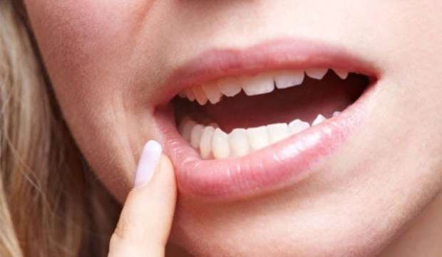 تفسير حلم سقوط الأسنان للعزباء
